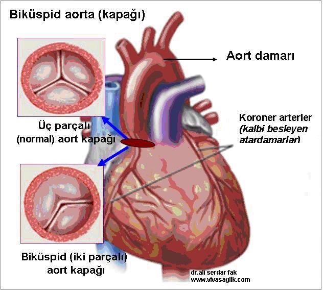 kalp-hastaliklari-10